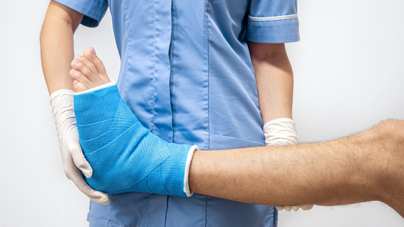 Sve što treba da znate o nošenju gipsa – priprema, nega i oporavak
